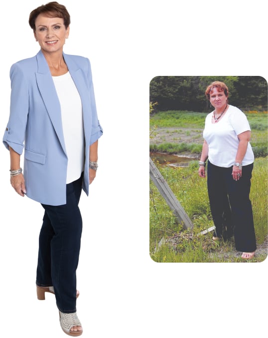 Debra Before and After Weight Loss Photo