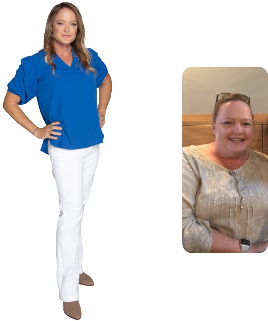 Fiona Before and After Weight Loss Photo