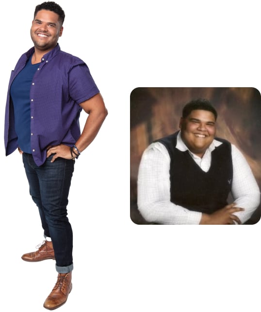 Ronalis Before and After Weight Loss Photo